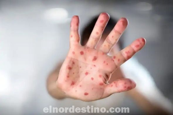 Cuando una persona infecciosa toca prendas de vestir, ropa de cama, toallas, objetos, aparatos electrónicos y superficies. Si alguien más toca estos artículos, puede infectarse. (Foto: Divulgación).