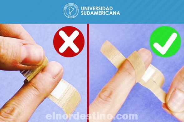 Las curitas no están hechas para las heridas en, por ejemplo, los dedos de las manos y de los pies, ya que suelen molestar mucho a las personas que las llevan puestas o se despegan debido a la fricción del movimiento. (Foto: Fanpage de Facebook de Universidad Sudamericana).