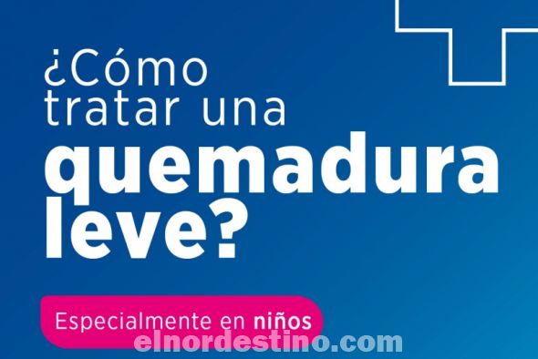 Universidad Sudamericana explica cómo practicar primeros auxilios en una quemadura leve, especialmente en niños